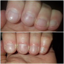 Load image into Gallery viewer, Liquid Skin Salve For Dry Skin - FREE Shipping