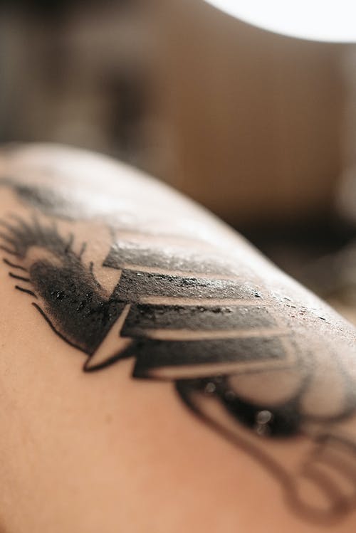 Details 160+ tattoo ink rejection