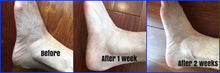 Load image into Gallery viewer, Before and After Photo and Testimonial | Liquid Skin Salve for Feet